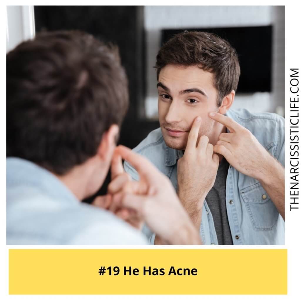 He Has Acne